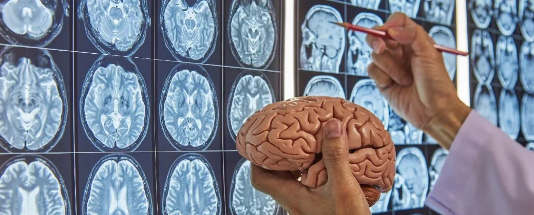 Glioblastoma-vacuna