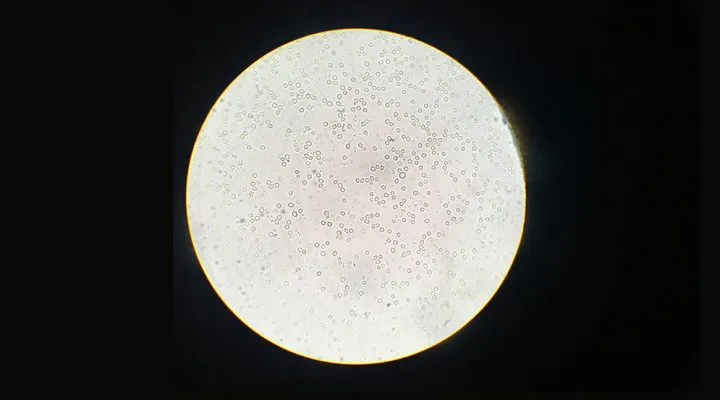 chagas vista microscopica